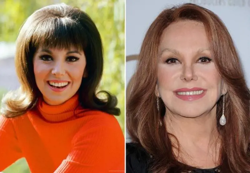Before and After Picture Of Marlo Thomas