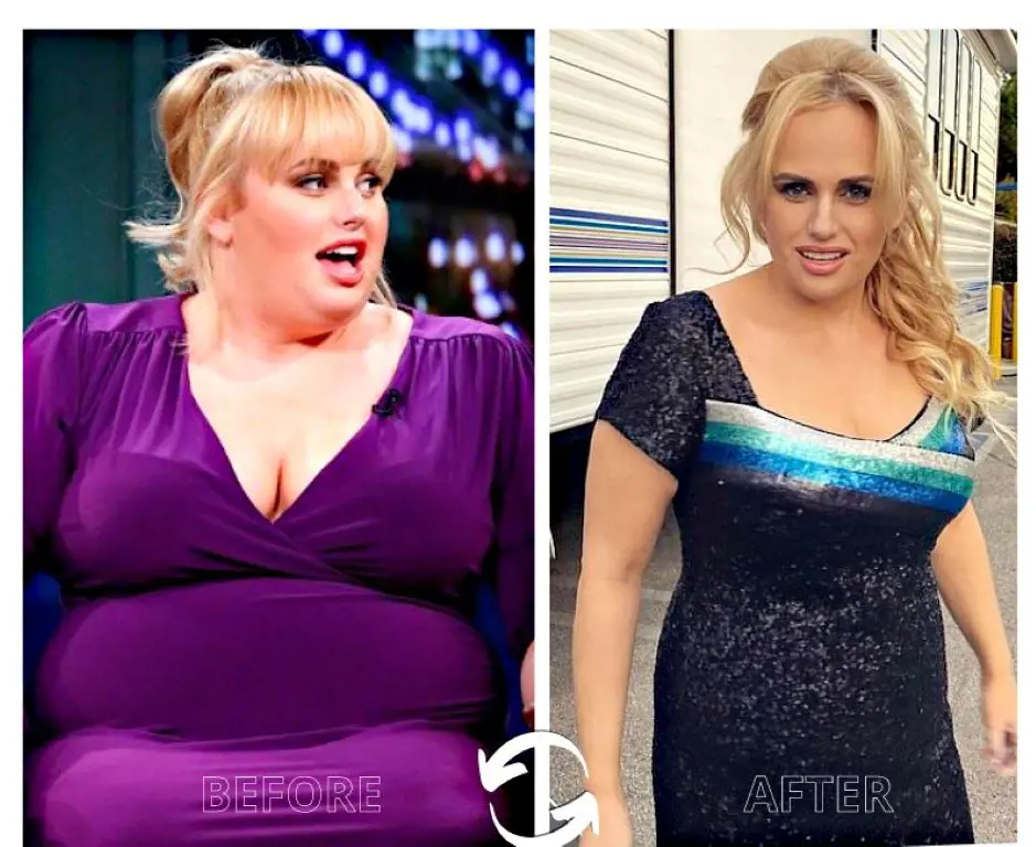 Did Rebel Wilson Undergo Surgery To Lose Weight? Health Problem - Before And After Photos