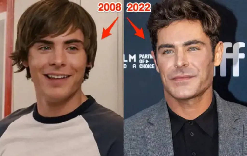 Comparison picture of Zac Efron in 2008 and 2022. There is seemingly noticeable change in his jawline.